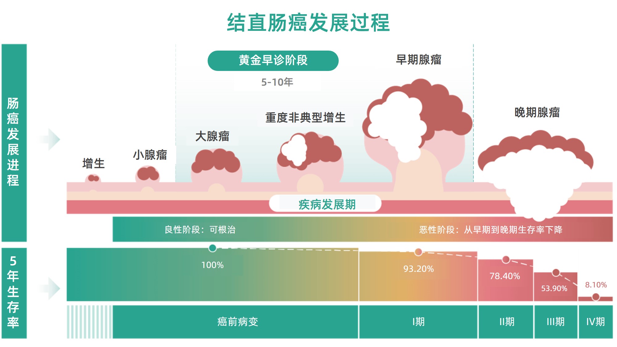 肠癌演变过程图.jpg 肠癌演变过程图.jpg